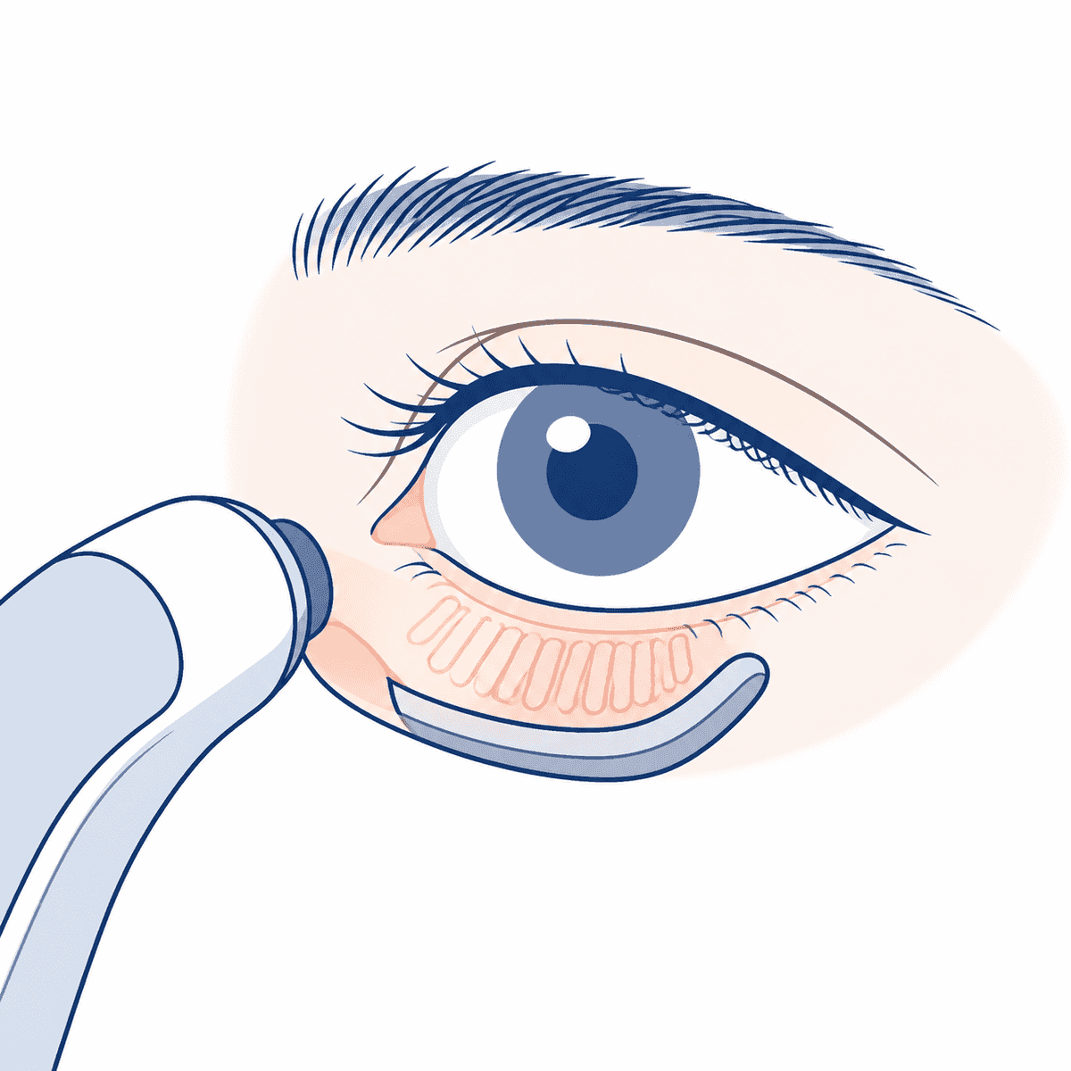 경기 남양주 안구건조증 안과 선택 기준: 인공눈물 처방을 넘어 원인 검사와 마이봄샘 평가 보기 핵심 정보 이미지